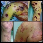 gaza-wounds-2-1